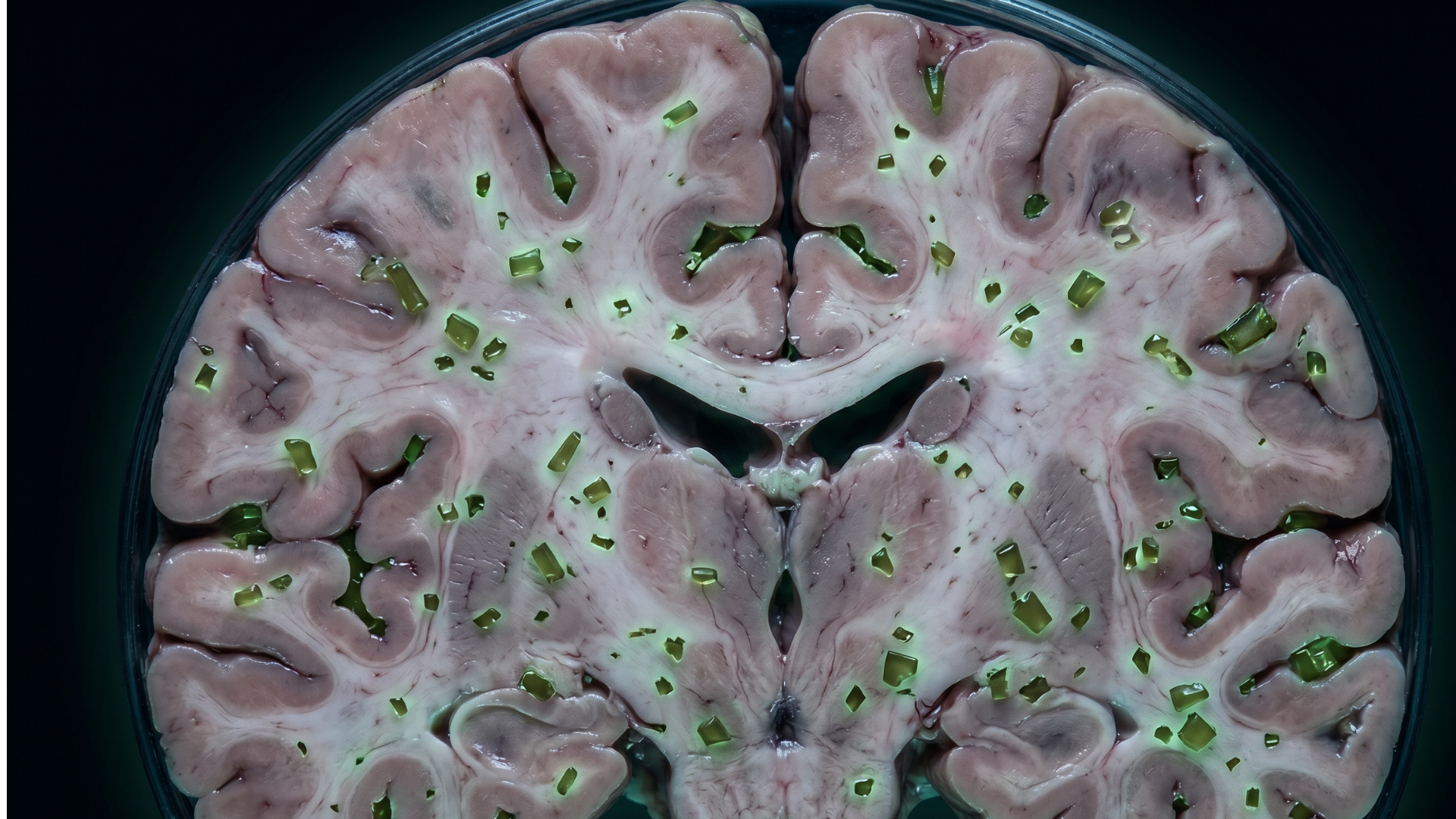 Already Inside You: Microplastics in the Human Body