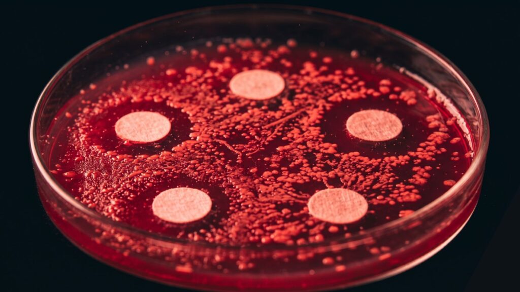 The Silent Pandemic